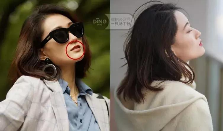 整牙给你点靠谱的建议,整牙亲身经历经验分享