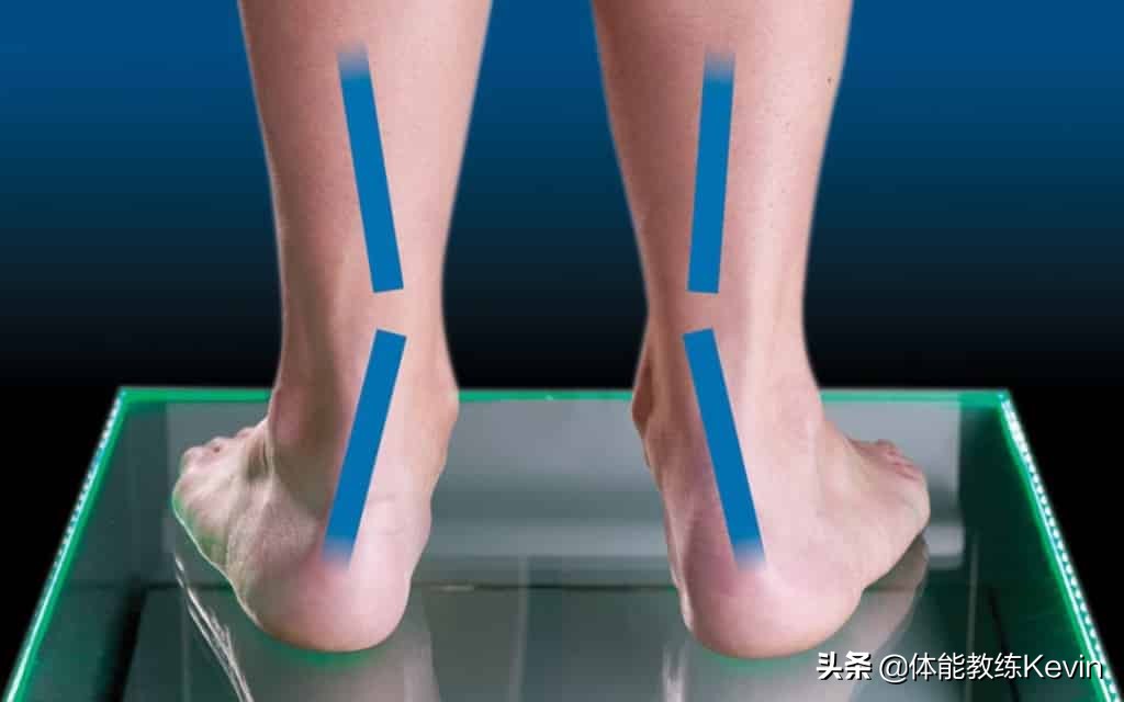 小儿足外翻康复训练弹力绷带,儿童足外翻康复训练教程