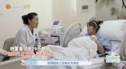 陈燃48小时宫缩乏力只能顺转剖:这几种情况不能再顺