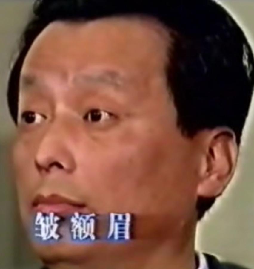 面神经炎治疗自述,面神经炎科普视频