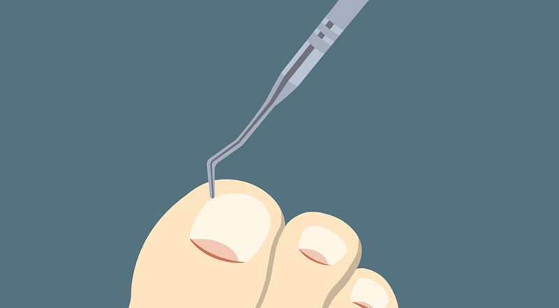 指甲出现问题跟什么脏腑有关,指甲出现问题一定要注意了