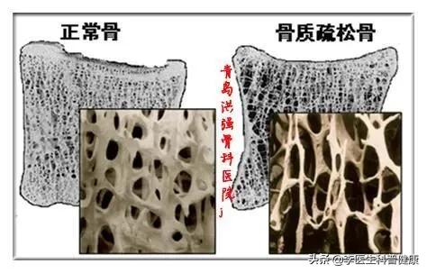 各种腰疼看过来自己一步搞定,腰痛的五种原因和处理方法