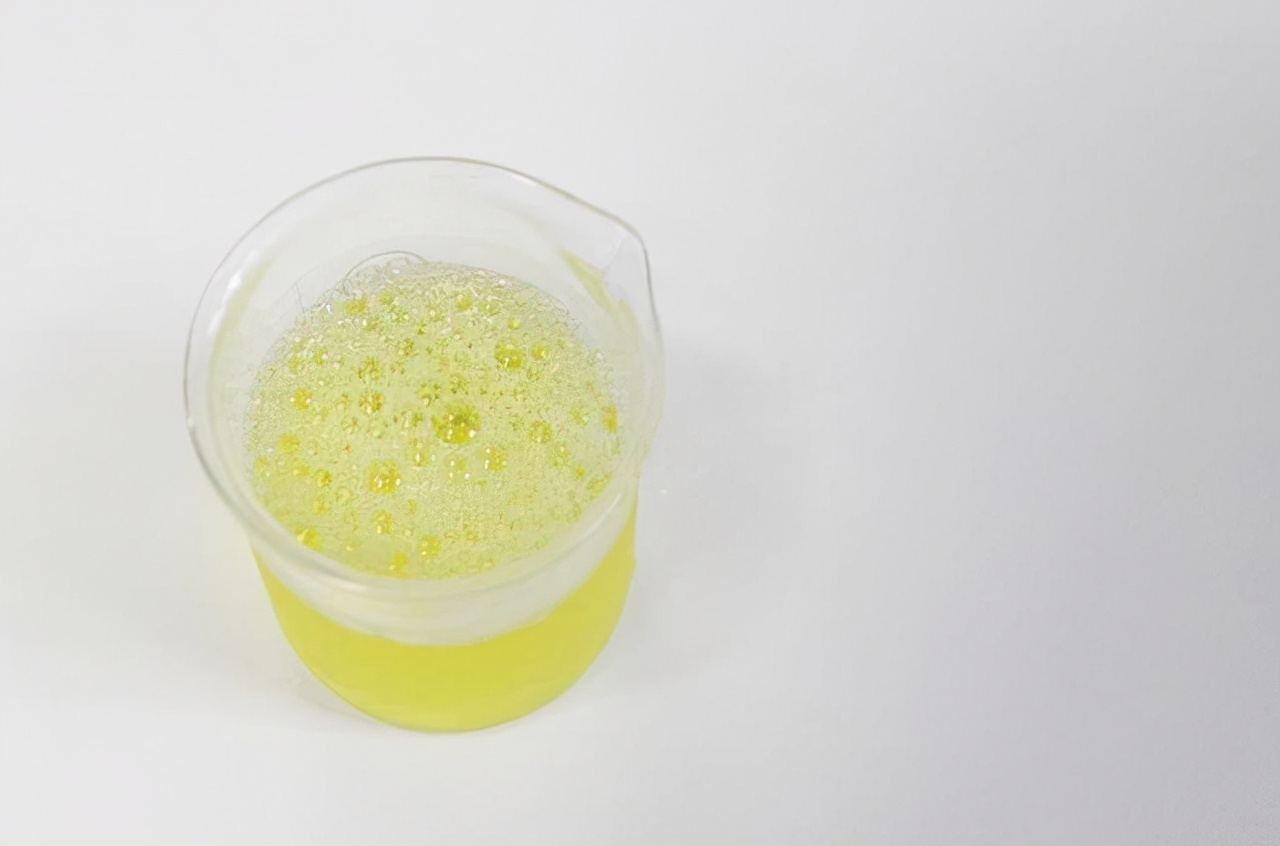 男性肾透支怎么调理,肾严重透支的5个信号你占几个