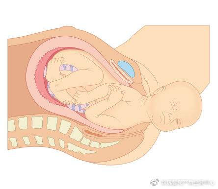 孕晚期特别燥热是快要出生了吗,孕晚期吃什么宝宝出生干净