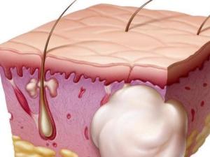 妇科炎症反复怎么去用中医药调理,妇科炎症反反复复如何提高免疫力