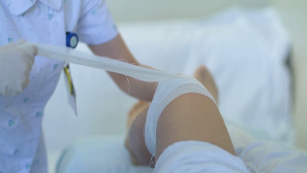 滑膜炎片治疗膝关节滑膜炎,膝关节的滑膜炎是怎么回事