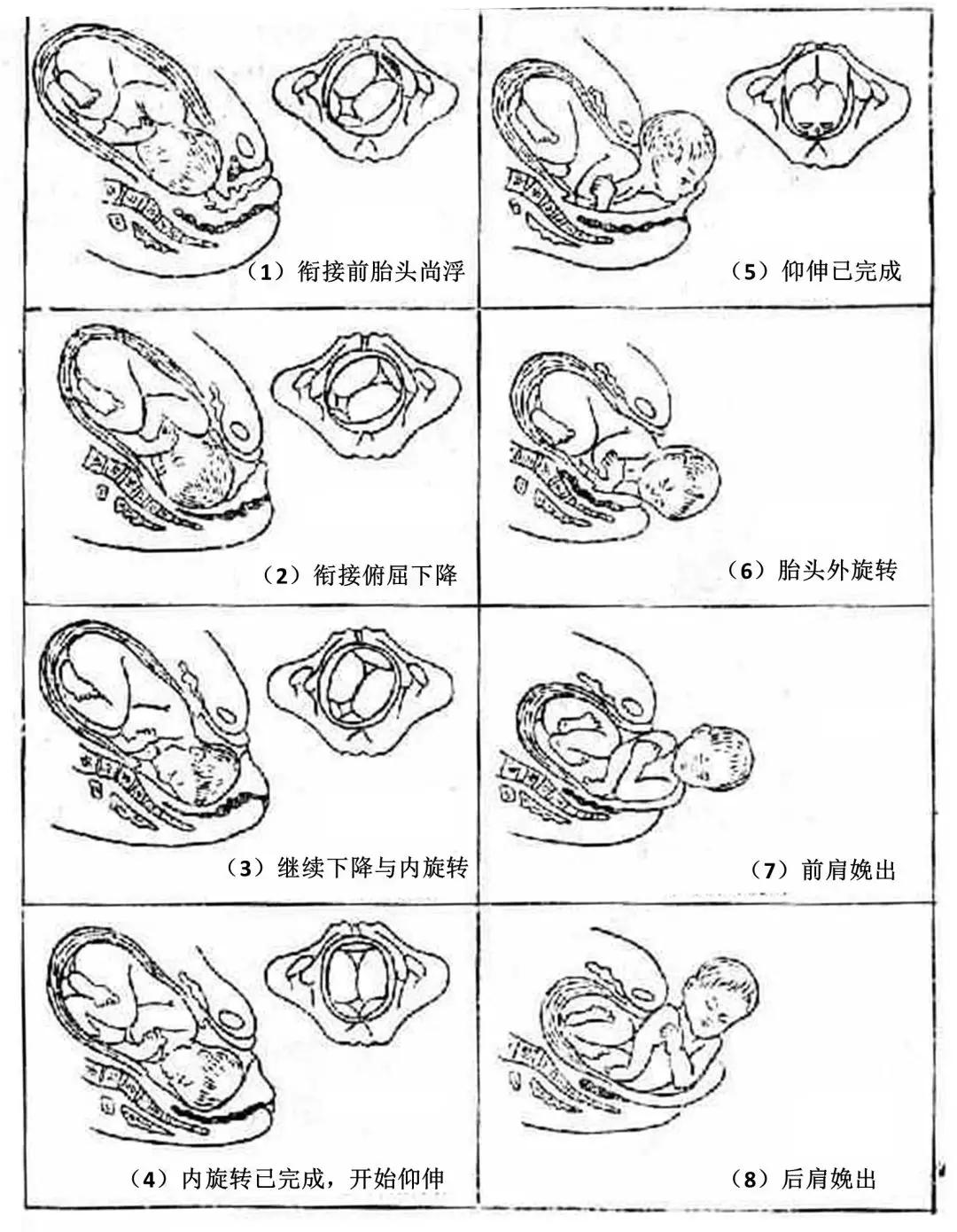 无痛分娩生完了还会痛吗,凭什么生孩子是女人的天性