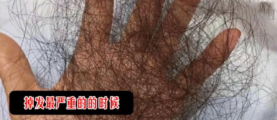 澳洲茶树精油洗发水去头屑,头发一摸全是油