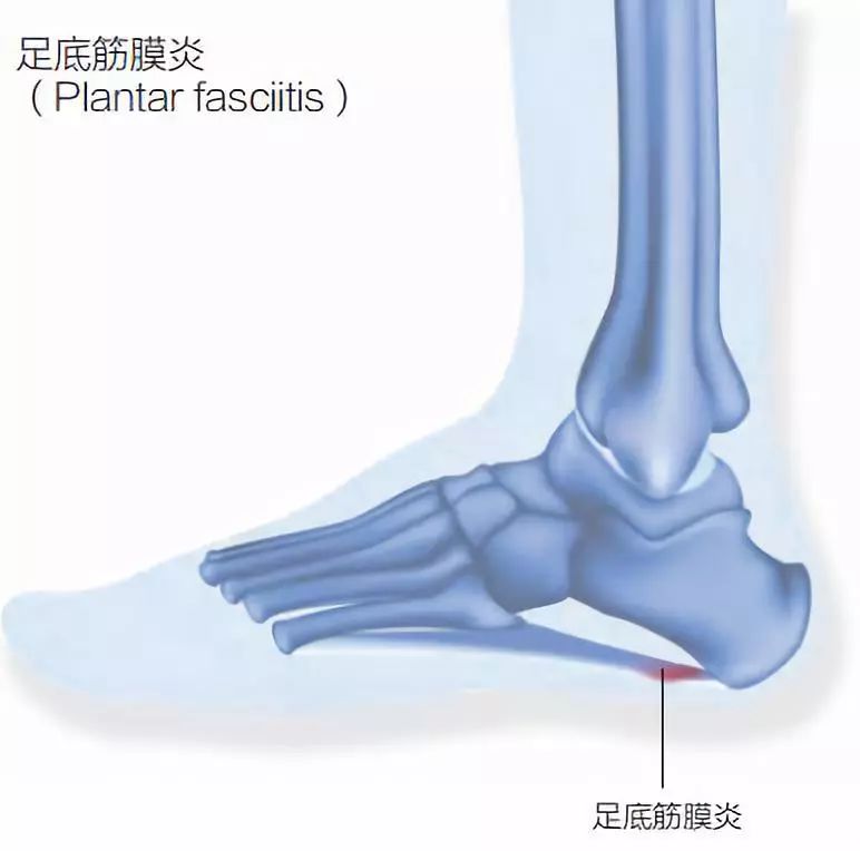 冬练三九的过冬方式,冬练三九注意事项