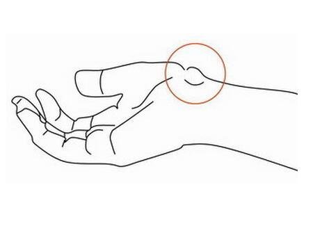 骨科可以治腱鞘囊肿吗,脚腱鞘囊肿最快的恢复办法