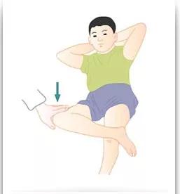 股骨头坏死跛行如何矫正,腿痛要警惕下肢缺血性疾病