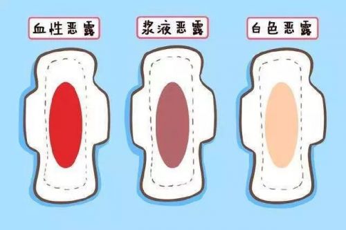 想知道产后恶露不尽的原因有什么,产后怎么知道是恶露还是月经