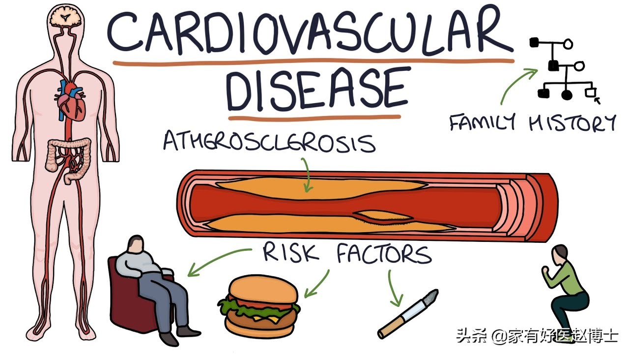 体检报告中常出现钙化哪些需警惕,钙化有什么症状和危害