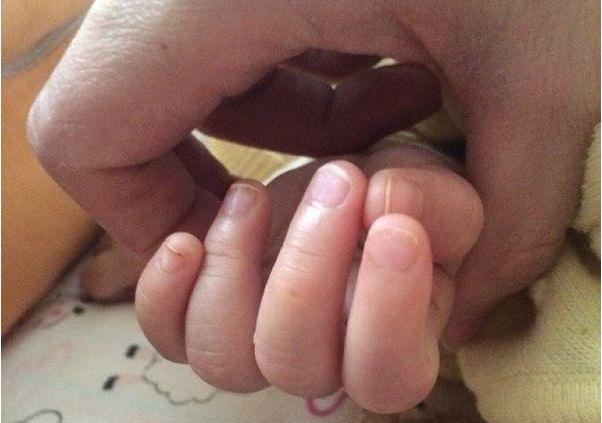 孩子爱咬指甲不爱吃饭怎么办,孩子不良习惯忍不住咬指甲怎么办