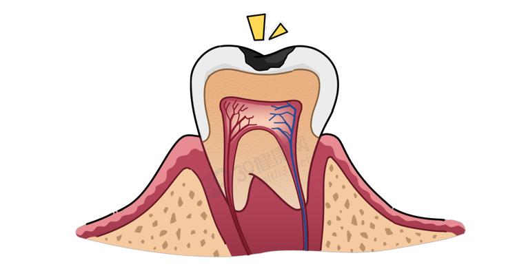隐形牙套能矫正整齐吗,为什么戴牙套会让人变好看