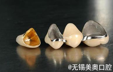 烤瓷牙和全瓷牙应该怎么选,全瓷牙和烤瓷牙会有口臭吗