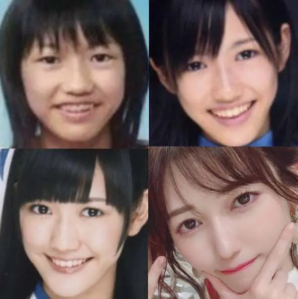 日本整容惊人案例,日本整容是不是最先进