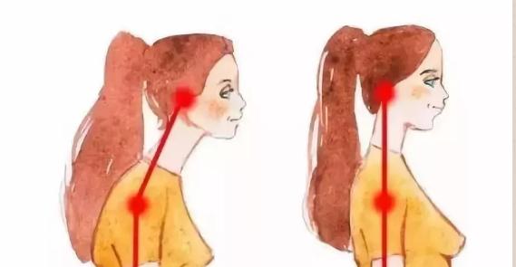 懒人纠正驼背的方法,改善圆肩驼背天鹅颈一字肩