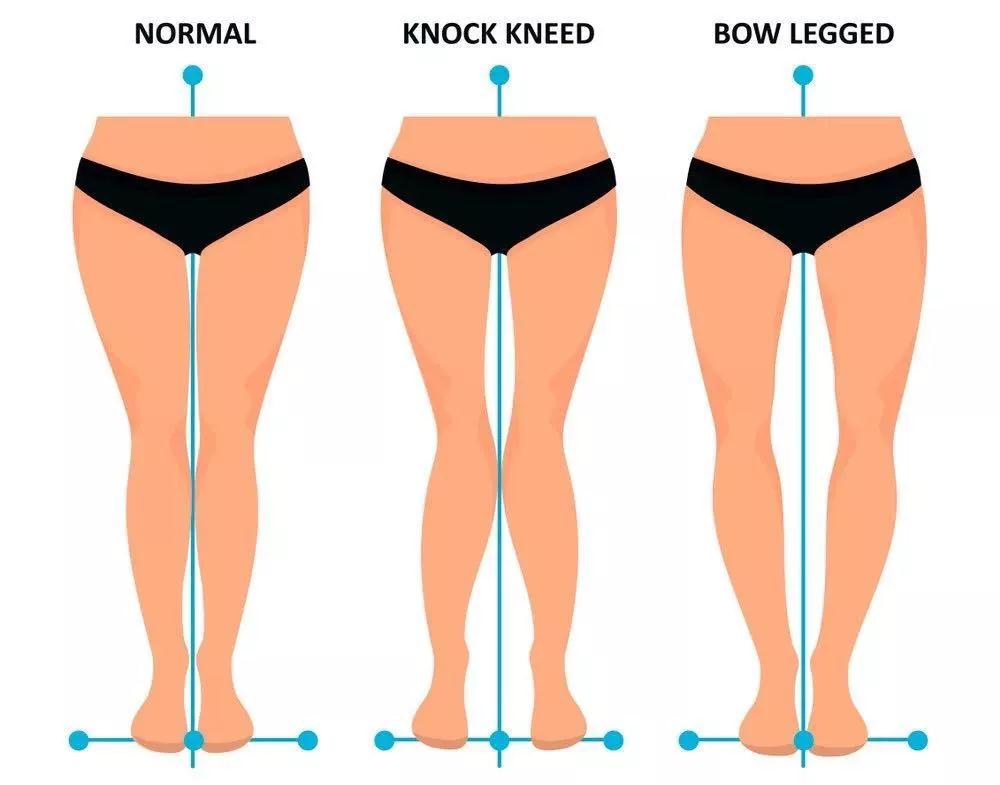 三个姿势改善体态,3个让人变丑的动作