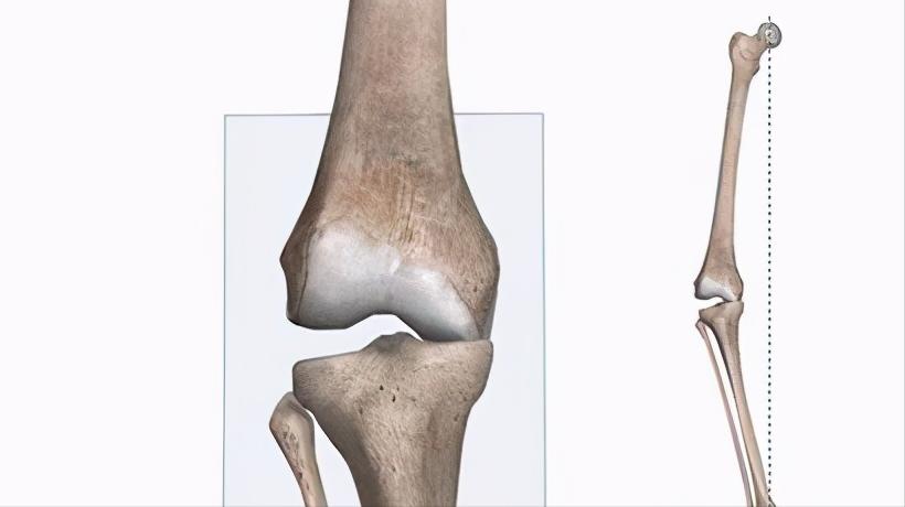 好久不活动一锻炼就膝盖疼,膝盖运动就疼休息就好