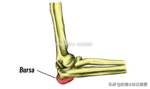运动肘关节常见创伤及治疗方法,怎么预防肘关节康复二次损伤