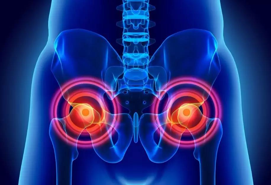 股骨头坏死疼痛按哪个穴道可缓解,股骨头坏死疼痛加重是不是塌陷了