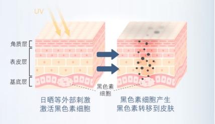 吉米祛斑抖音,吉米祛斑品牌