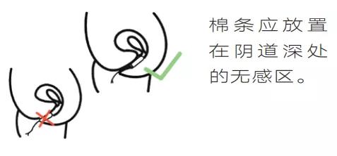 我用的不是棉条,是自由丨棉条科普