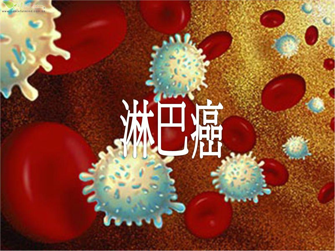 淋巴癌不干预会发展多久,淋巴癌怎么保守治疗最好