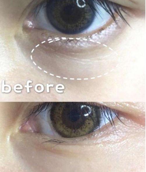 屈臣氏一款眼霜富含六胜肽,对女性眼部有着什么样的作用?