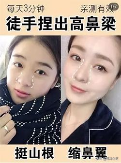 小红书用户分享的双眼皮、高鼻梁、小V脸、减肥方法，好评or差评