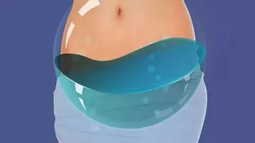 体检查出盆腔积液，听说还影响生育，这真是一肚子“坏水”？