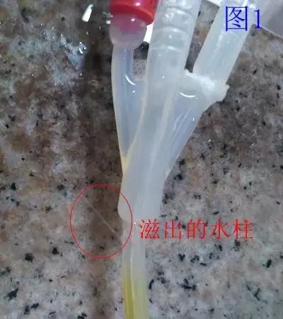 正确的膀胱冲洗是怎样的?咋预防脱管?