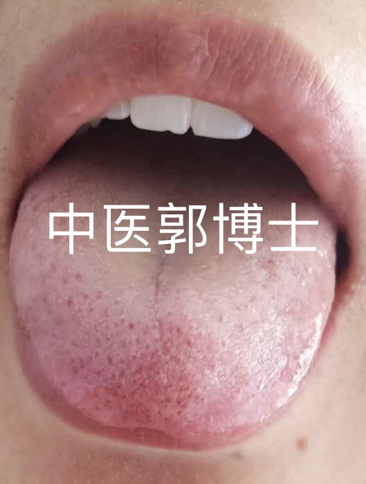 胸闷痰多用什么中药方解决,经常胸闷气短吃什么药效果好