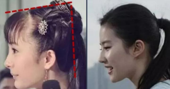 抗衰不再是简单的面部抗衰,抗衰老增加颜值