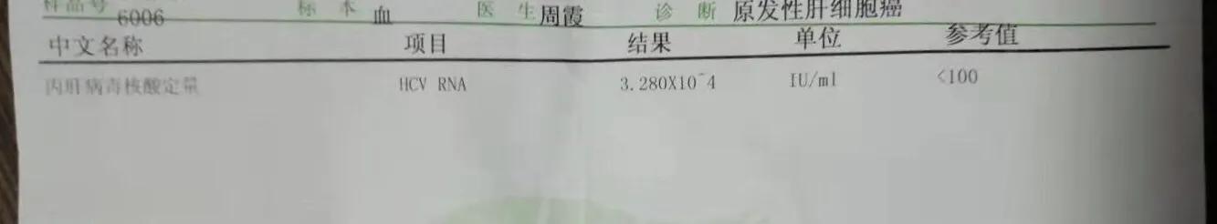 辟谣肝功能,丙肝应要如何护肝医生告诉你