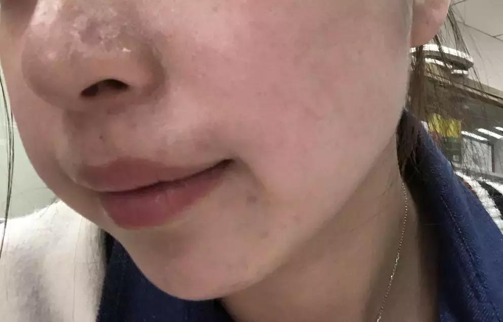 一到晚上皮肤暗沉发黄,一到下午皮肤暗沉