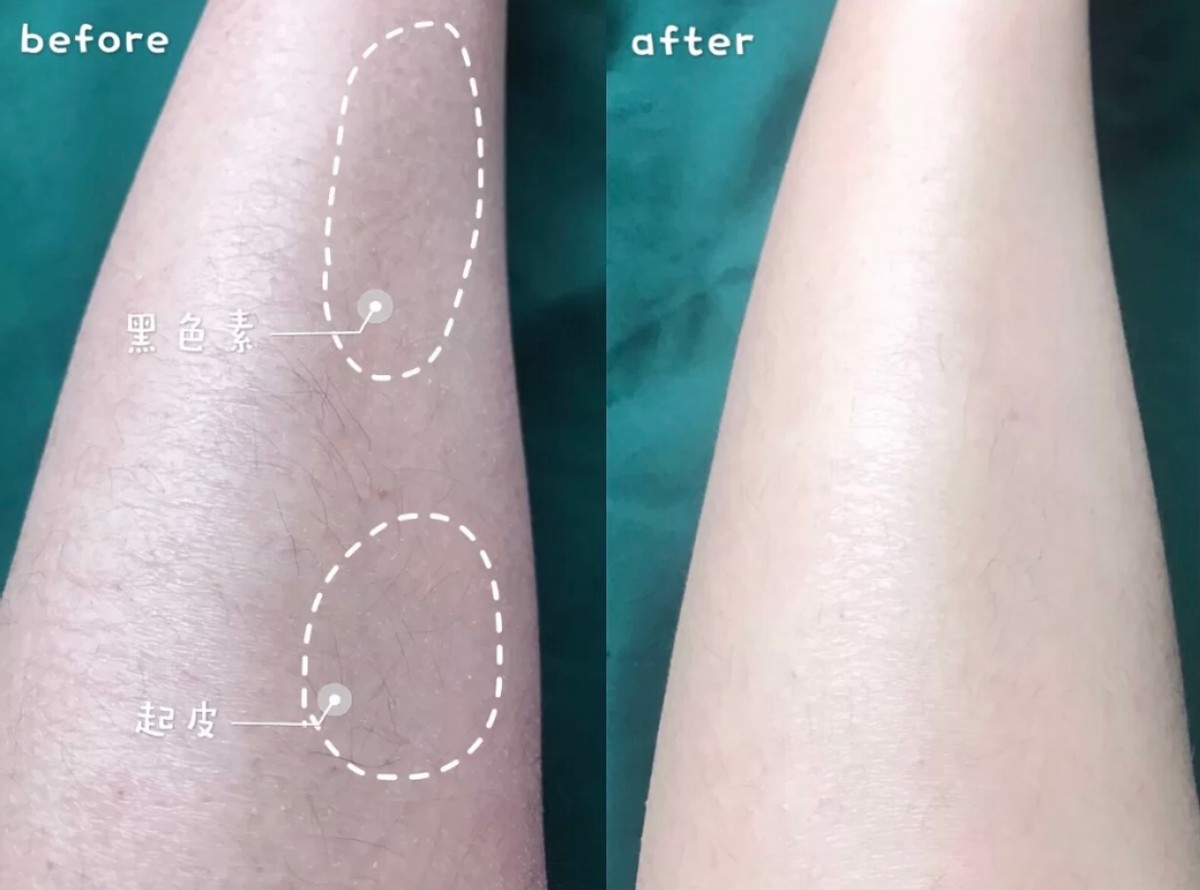 再不抗老你就老了完整版,再不抗老你的青春还留得住吗