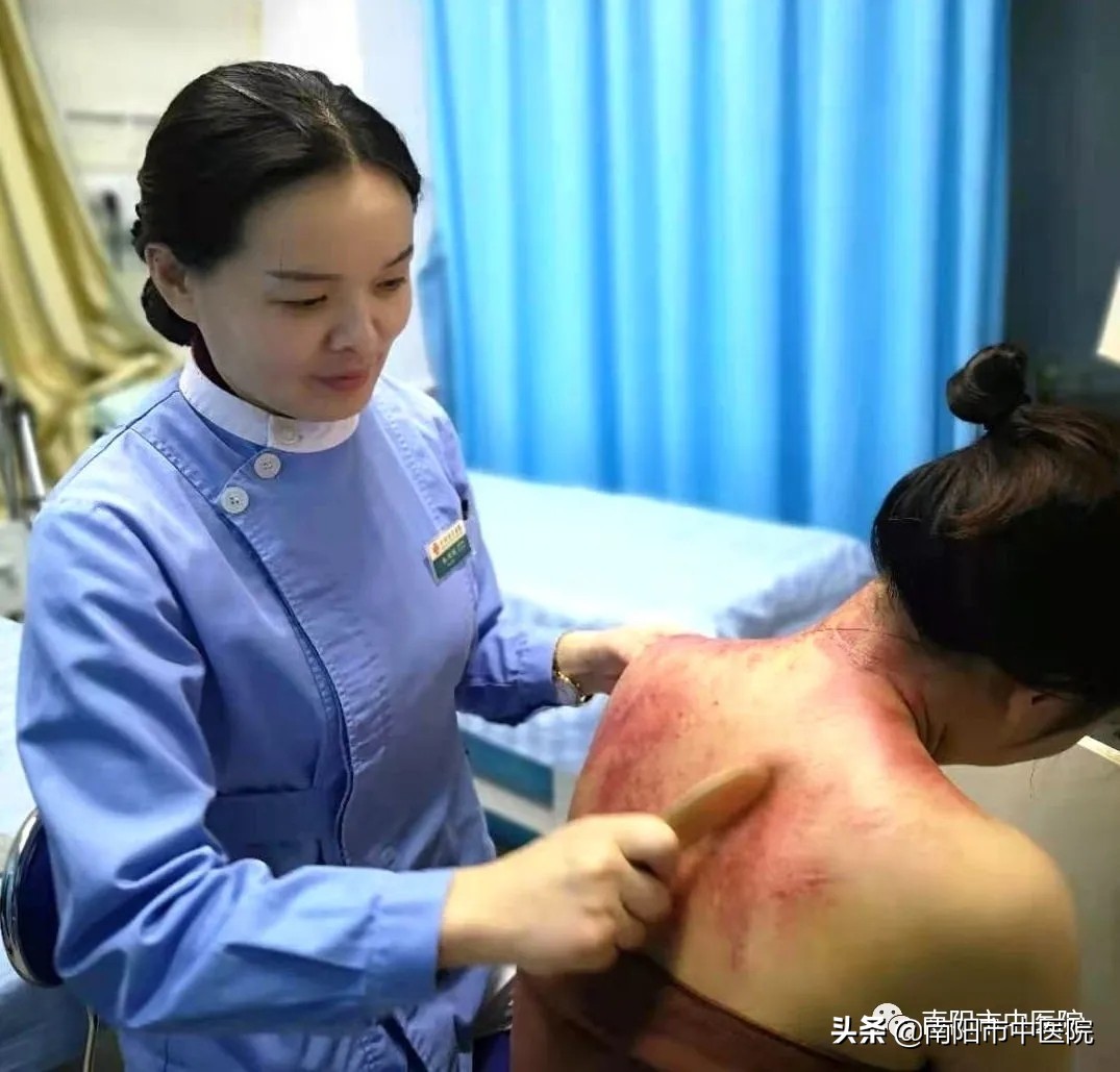 南阳市中医院开展多种中医特色治疗项目——虎符铜砭刮痧