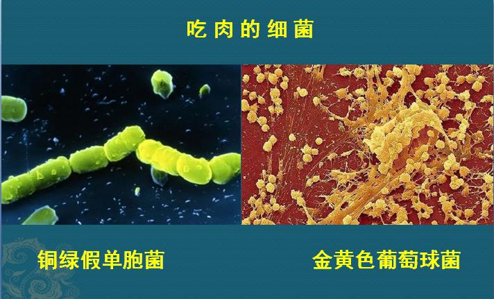 这个细菌提醒你,别买病死的鱼,它是个吃草的细菌,后来学会吃鱼