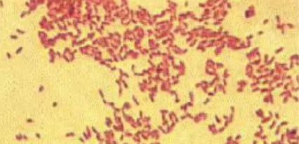 奶牛布氏杆菌病怎么治疗,奶牛怎么检测布鲁氏菌