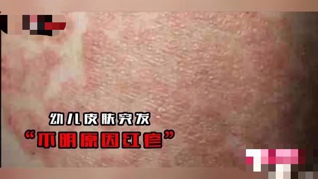 湖南郴州大头娃娃奶粉持续发酵,郴州大头娃娃奶粉事件