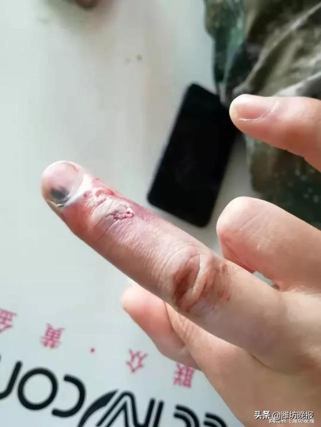 疫情我们能熬过去吗 (如果疫情再下去你能熬多久)