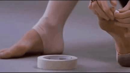 练芭蕾会导致膝超伸吗,练芭蕾舞的脚有多可怕