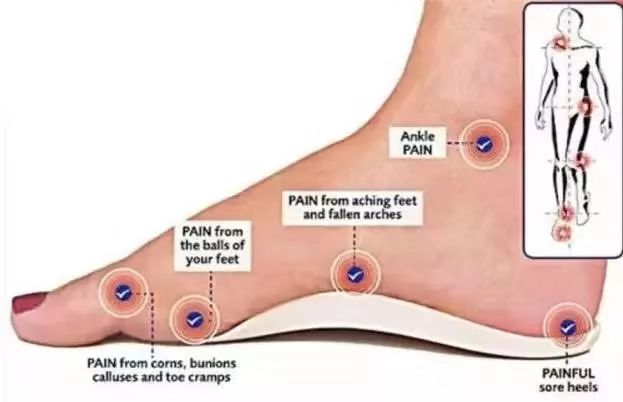 西安治疗扁平足最好的医院,扁平足拇指外翻的治疗方法