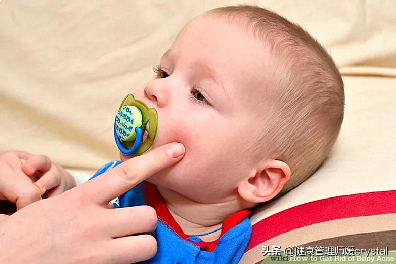 宝宝脸上长小痘痘是痘痘还是湿疹,宝宝痤疮消除后还是偶尔起痘