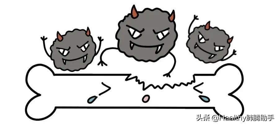 肺癌骨转移的十大症状,肺癌骨转移七大疑惑