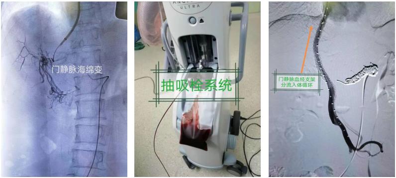 南昌大学二附院消化外科主任,南昌大学一附院消化内科专家排名