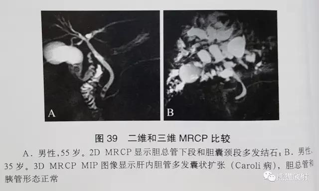 磁共振泌尿系水成像检查注意事项,磁共振影像基础知识讲解
