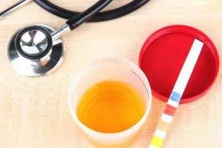 手指痛风的症状和治疗,尿酸高痛风症状的图片